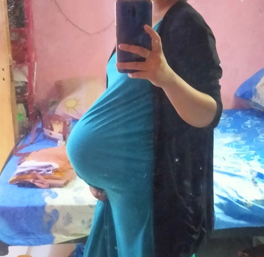 ukuran perut yg besar di usia 34 minggu