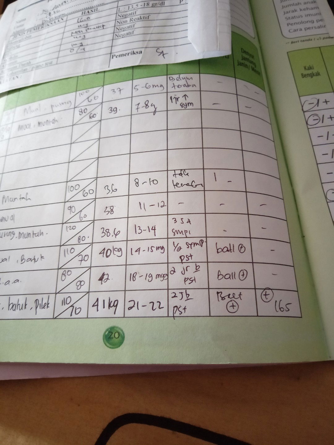 djj janin terlalu cepat