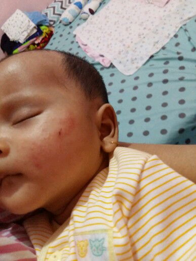 Pipi merah2 karna sering dikucek