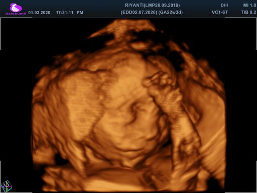 Rianti Bs profile icon