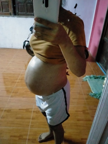 อัตราซาวน์เพศลูกตรงตามหมอบอกมั้ยคะ