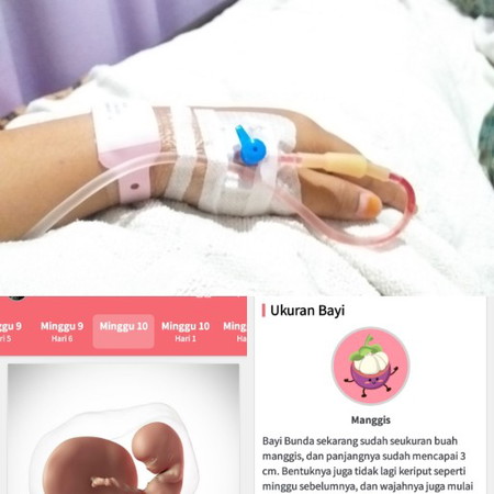 7 desember 2019 harus berpisah, dan harus di kuret