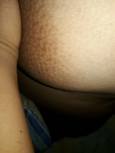 คุณแม่บ้านไหนเป็นกันบ้างคะ