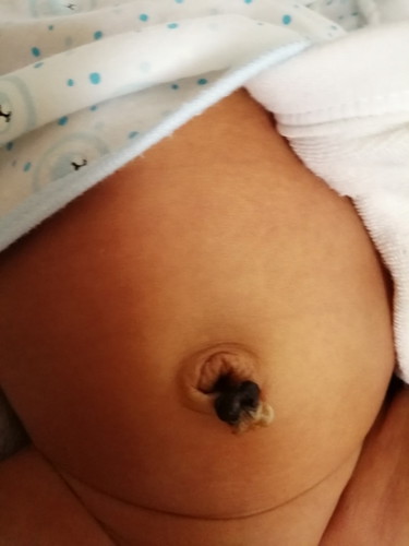 Umbilical Cord