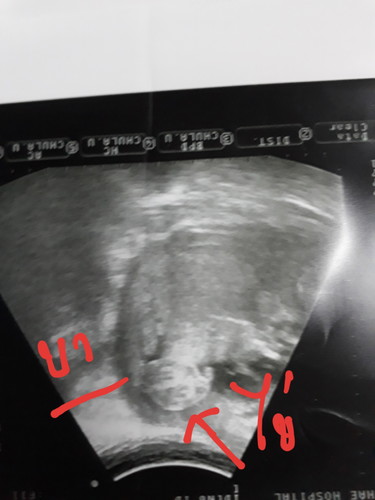 ผลซาวด์