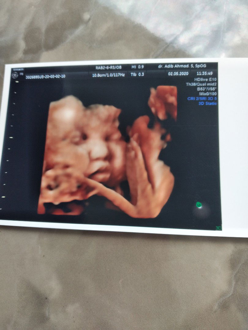 Ifa Ayu Purwantini II profile icon