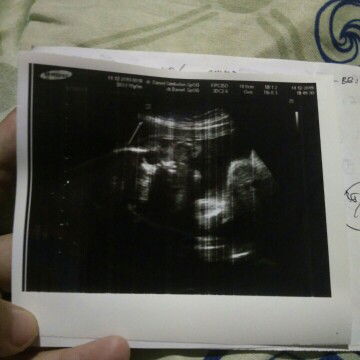 muka ketutup tali pusat