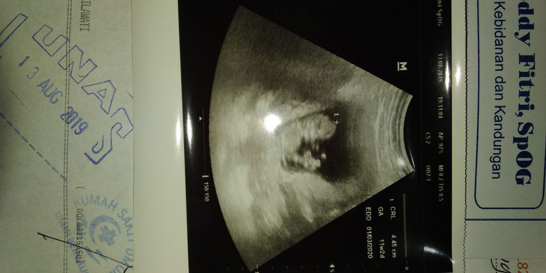 ini adik laki2 atau perempuan ya