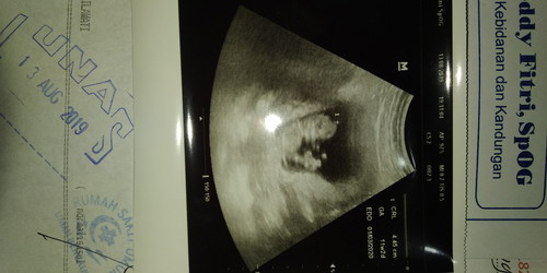 ini adik laki2 atau perempuan ya