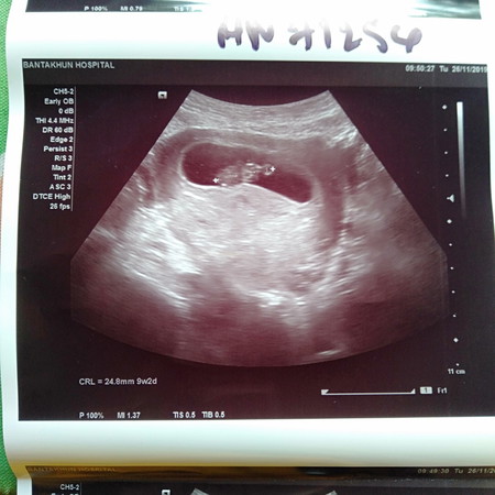 ได้เจอกันครั้งที่ 2 my baby