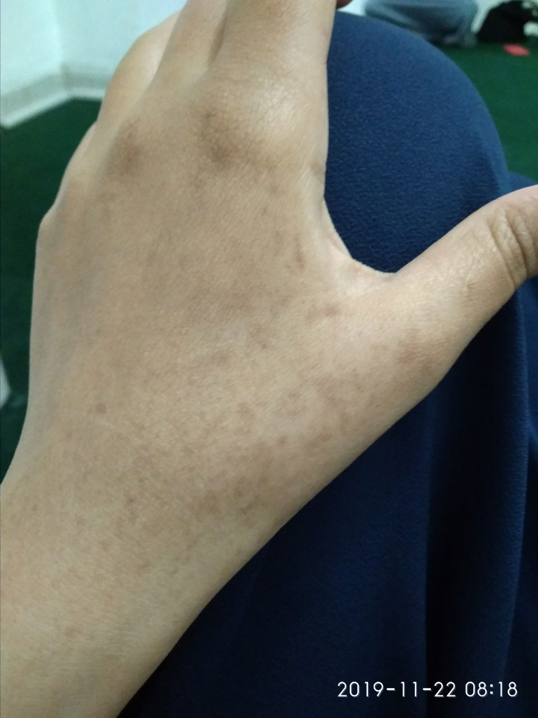 tanda dari kehamilan