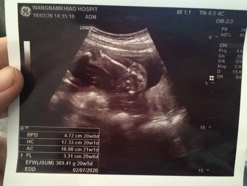 ดูยังไงค่ะว่าทางไหนหัวน้อง