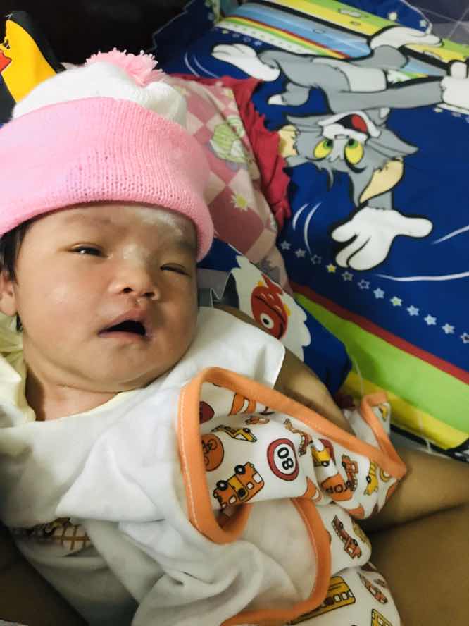 การได้ยินของเด็กเเรกเกิด