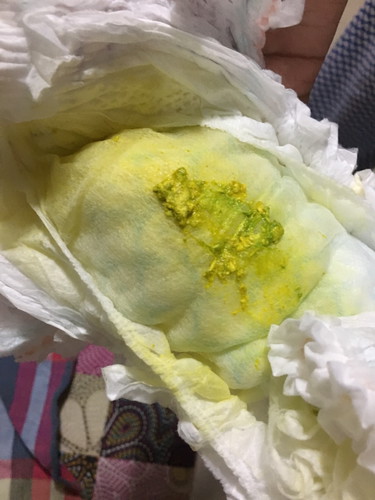Green ?