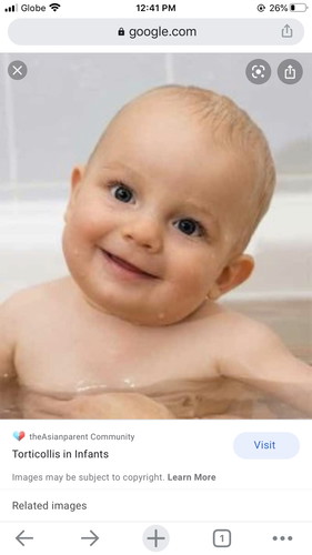 Anong po g peseng gawin kc tabingi po ung ylo ni baby umiiyak po xa pag pna pa left syd ko ung ulo nyah Gnito po xa lgi ok nmn po ung head shape nya