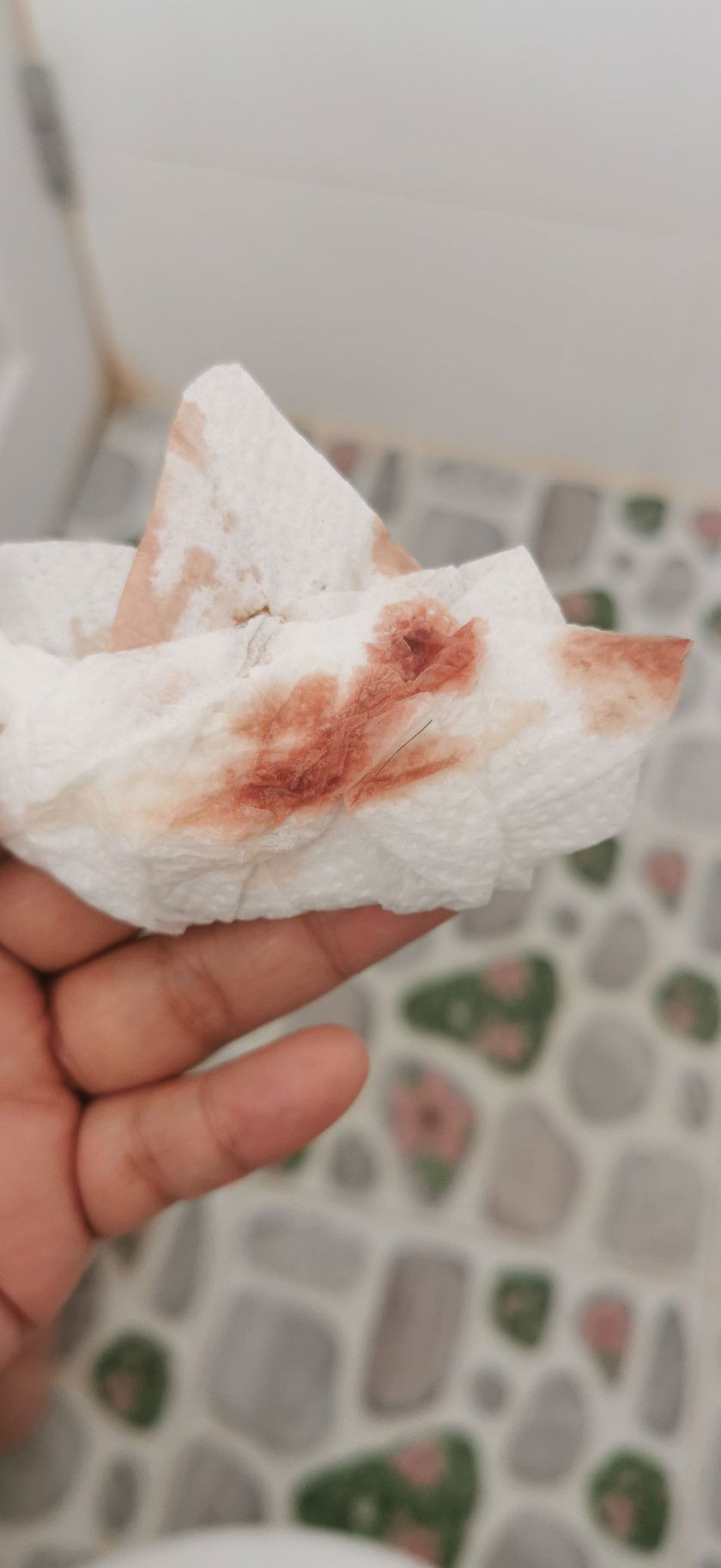 เลืิอดออกอีกแล้ว​   ?