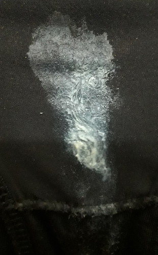 คืออะไร