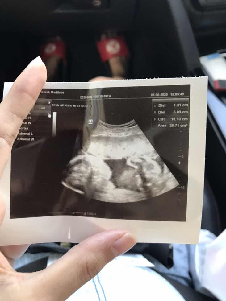 สงสัยเรื่องขนาดของลำตัวน้อง