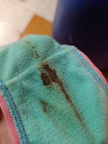 I am 7 weeks pregnant. Yesterday I found something on my panty.