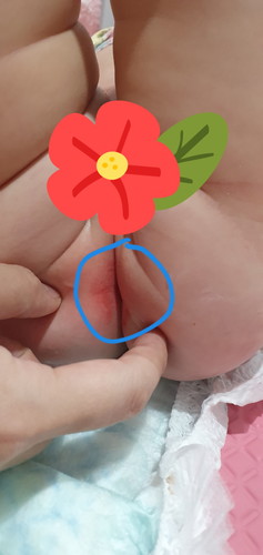 Constipated 6 Month Old