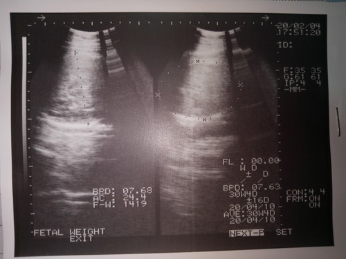 เเม่มือไหม่