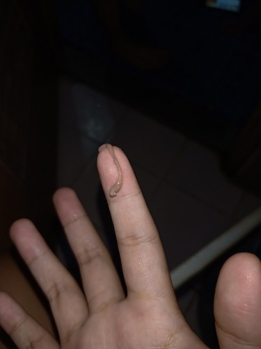 mucus plug?