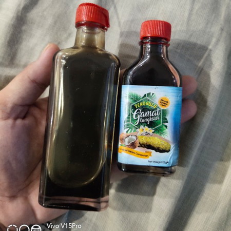 Buasir teruk ketika hampir bersalin