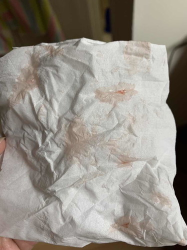 ตอนนี้ท้อง7เดือน แต่มีเลือดออกมาทางช่องคลอด แม่ๆท่านอื่นเป็นมั้ยค่ะ