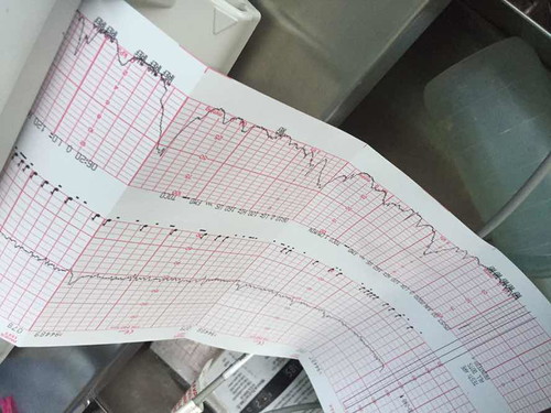 เจ็บเตือนมาแล้ว