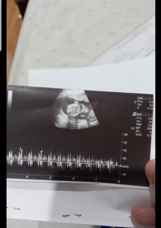 baby girl or baby boy?