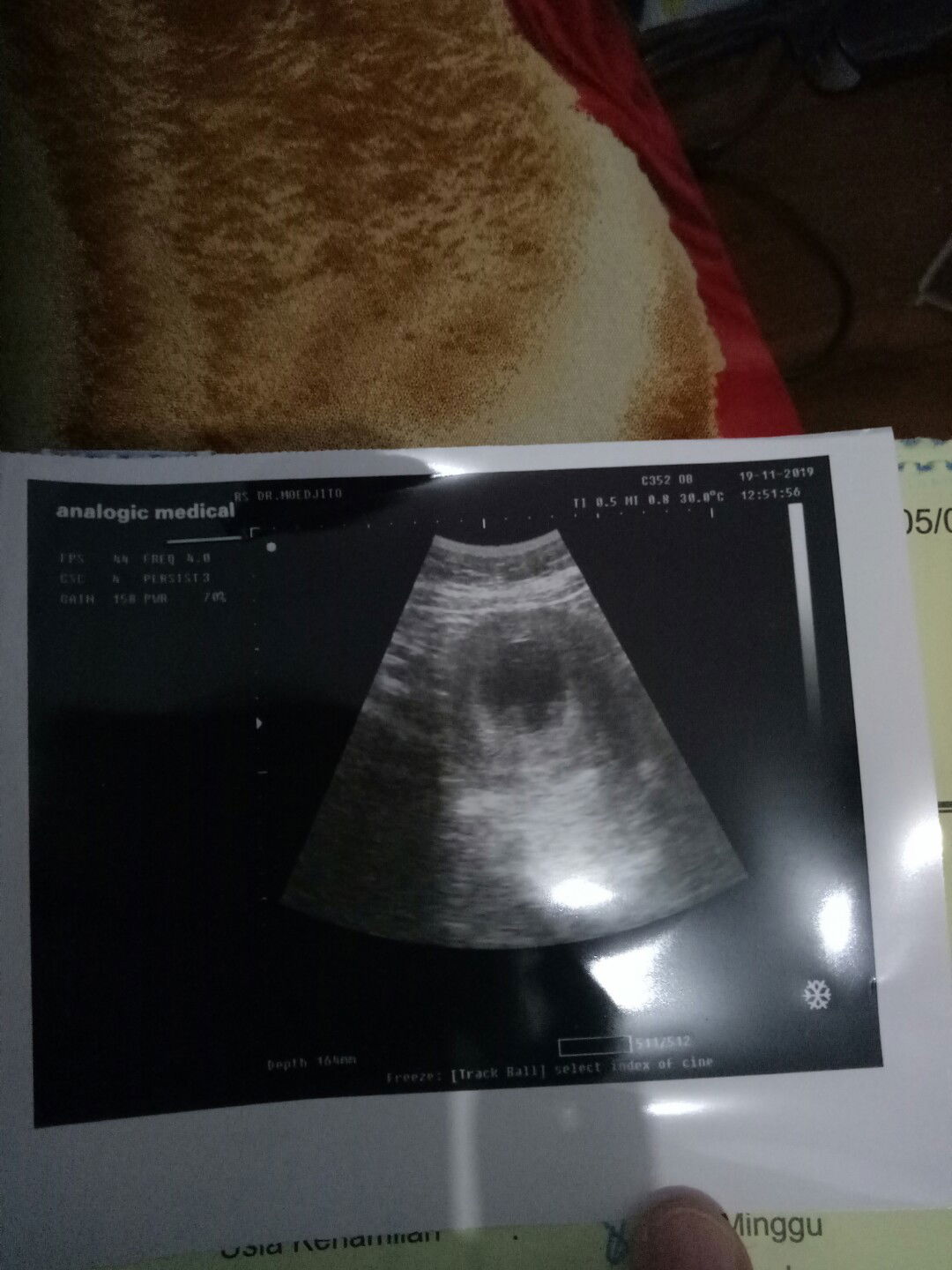 takut karena kehamilan pertama