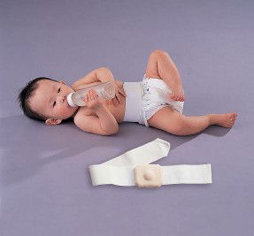 Makida's Umbillical Truss