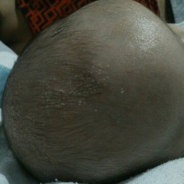 sa ulo ni baby mai parang tuyong nana.