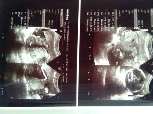 32weeks