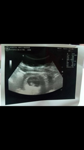 Alhamdulillah.. 8 weeks 5 days..