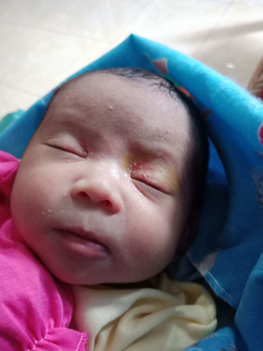 bintik putih kecil di sekitar mata