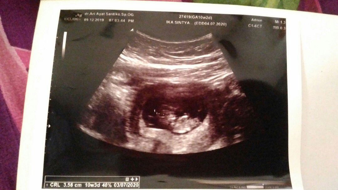 ada kantung di sebelah janinku