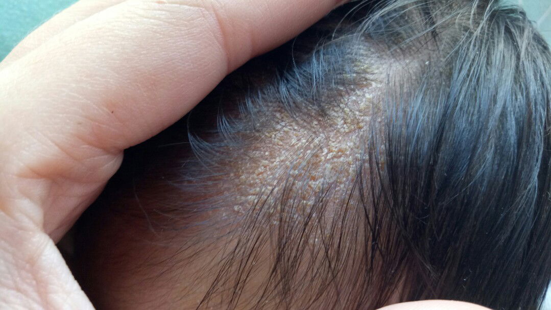 ขอคำปรึกษาหน่อยจ้า