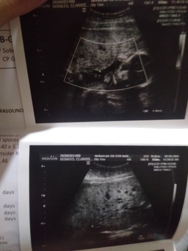 FIRST TIME MOM HERE NEED ADVICE PO