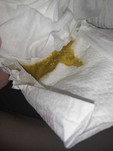 baby poop