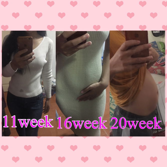 ท้องเล็ก?