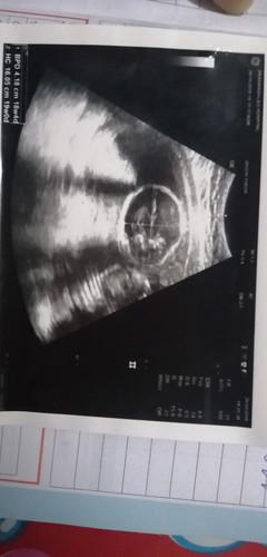 ลูก??ของพ่อ