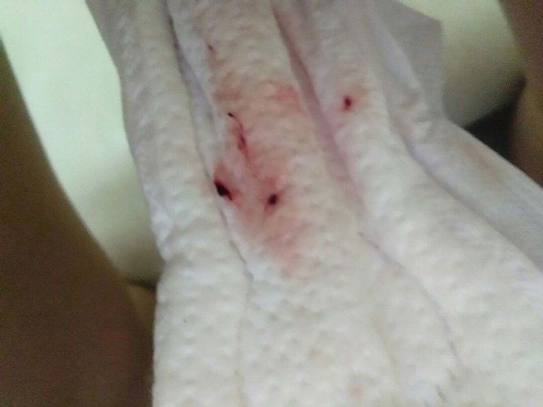 มีเลือดไหล 38วีคเต็ม