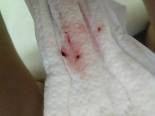 มีเลือดไหล 38วีคเต็ม