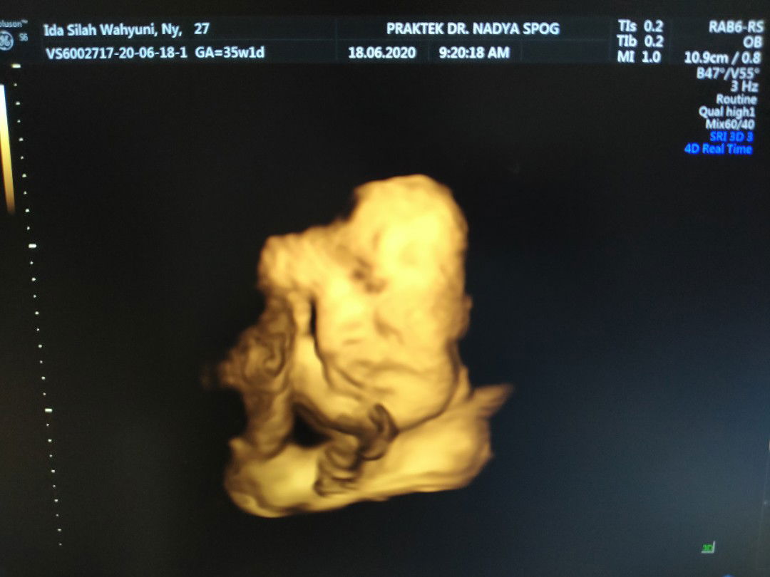 Ida Silah Wahyuni profile icon