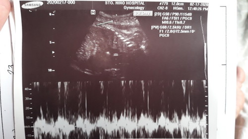 Sonogram