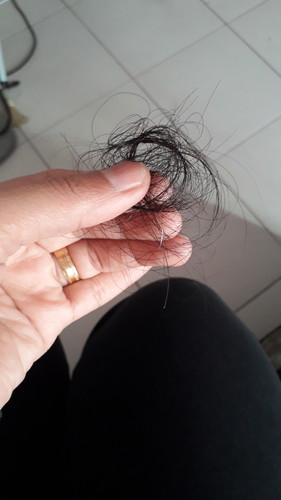 Rambut gugur.