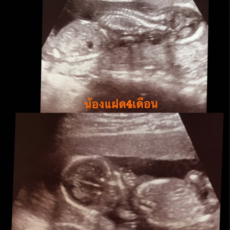 ชาย/หญิง ค่ะ?