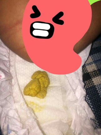 Newborn Poop