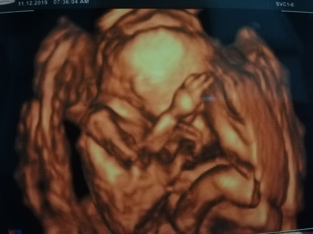 Dokter Kandungan Surabaya